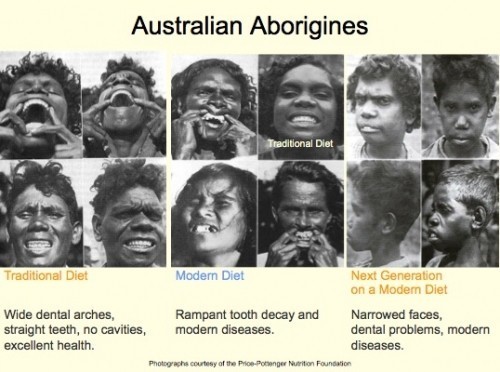 Left: thriving on ancestral diets. Centre: decline with modern diets. Right: the visible impact on children's health.